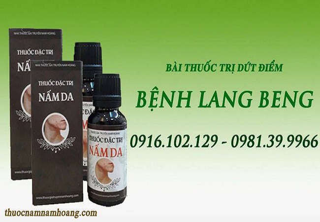 Cách điều trị lang beng hiệu quả nhất được nhiều người làm