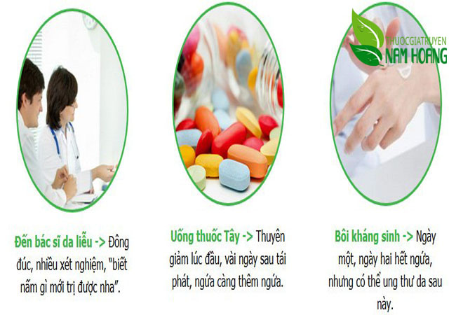 Thuốc bôi nấm da tốt nhất hiện nay được nhiều người dùng